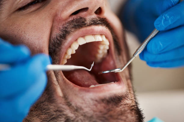 Best Urgent Tooth Repair  in Red Hill, PA